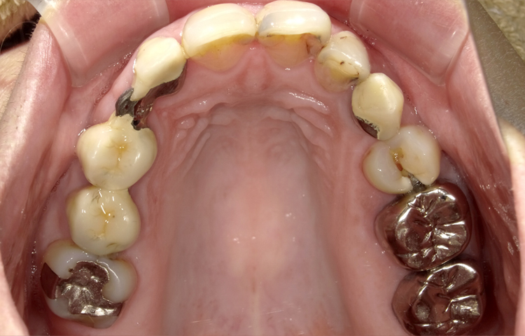 審美治療の症例写真